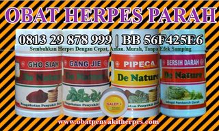 Illustration for article titled Obat Penyakit Herpes